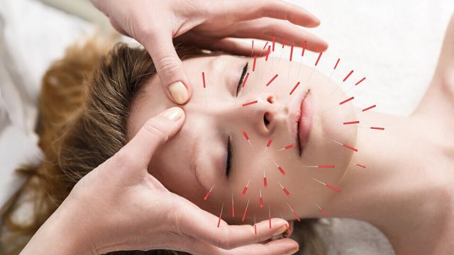 درمان آکنه یا جوش صورت با طب سورنی